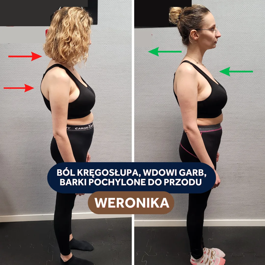 Weronika - ból kręgosłupa i postawa