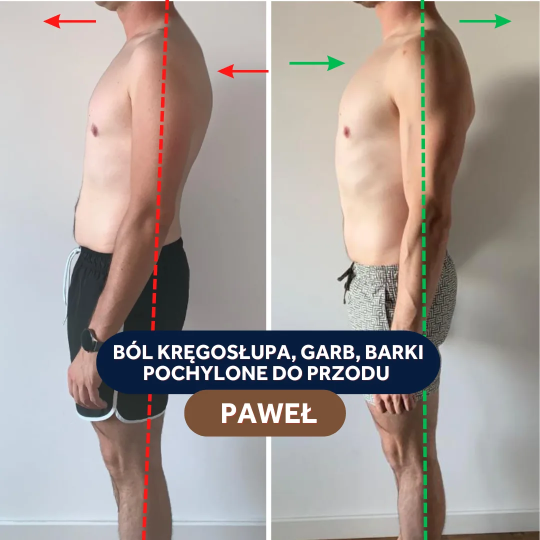 Paweł - ból pleców i -22 kg